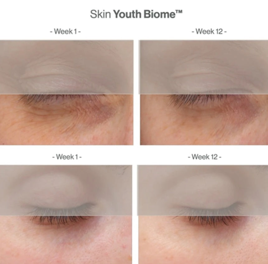 ANP Skin Youth Biome™ 維C美肌益生菌療程(升級配方)
Skin Youth Biome